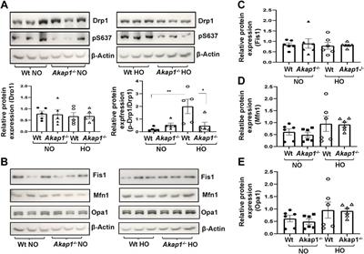 A-Kinase Anchor Protein 1 deficiency causes mitochondrial dysfunction in mouse model of hyperoxia induced acute lung injury